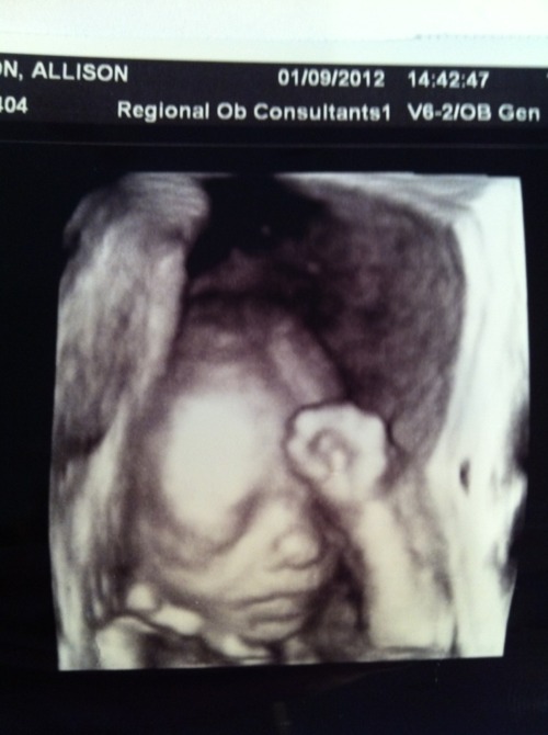 Preborn Tebowing