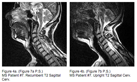 Breakthrough MRI scans